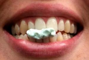 Diş ve Ağız Sağlığı